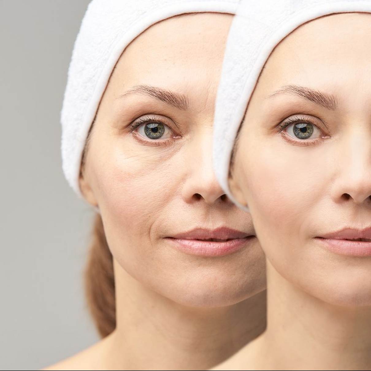 soins du visage Les peaux exigeantes - ma parenthèse