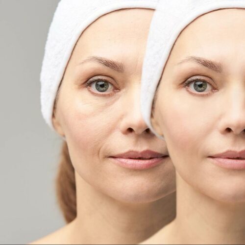 soins du visage Les peaux exigeantes - ma parenthèse